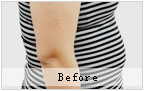 减肥对比 美女梦工场亚娜精致蜕变