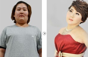 铭医整形专家胖脸原因分析并列举瘦脸方案