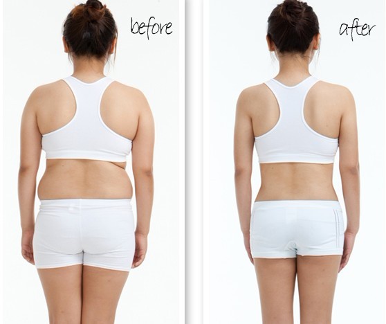 水动力吸脂,吉林铭医