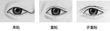 双眼皮,类型,吉林铭医