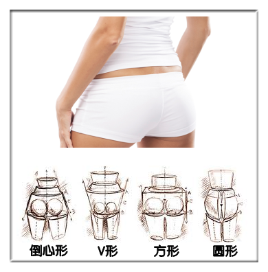 臀形,常见,吸脂,吉林铭医