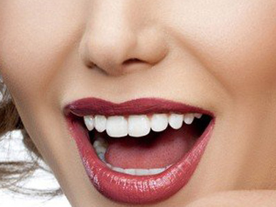 洗牙,吉林铭医,长春好的整形医院