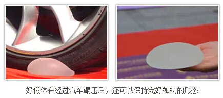 假体,隆胸,丰胸,长春好的整形医院