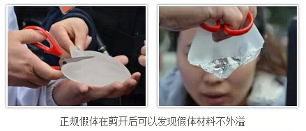 假体,隆胸,丰胸,长春好的整形医院