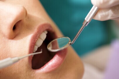 各种美白牙齿方法大PK