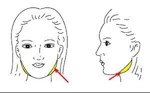 瘦脸,BOTOX,瘦脸针,长春好的整形医院