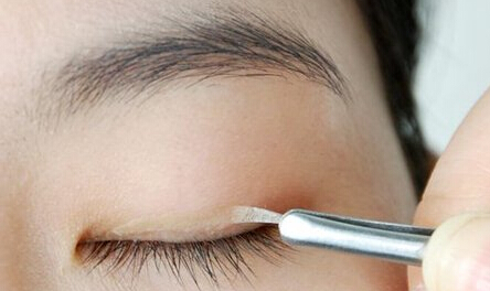 单眼皮,双眼皮贴,长春好的整形医院