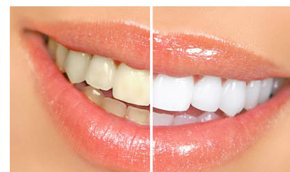 洗牙,对比图,长春好的整形医院