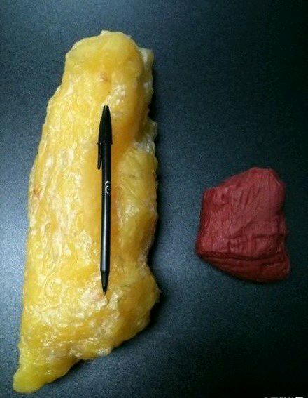 科普图,肪脂,长春好的整形医院