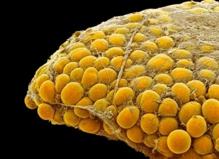 科普图,肪脂,长春好的整形医院