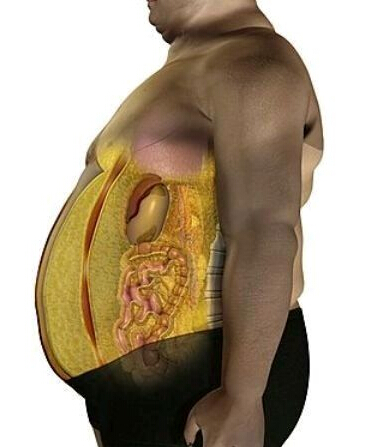 科普图,肪脂,长春好的整形医院