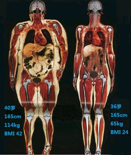 科普图,肪脂,长春好的整形医院