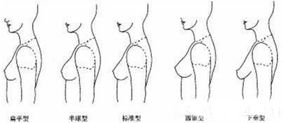 精致胸部,标准,外形,长春好的整形医院