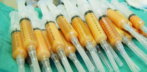 自体脂肪,隆胸,原理,长春好的整形医院