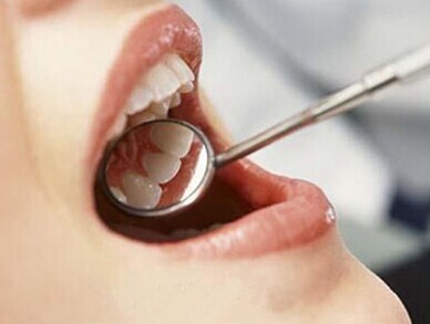 超声波洗牙,长春好的口腔,吉林铭医