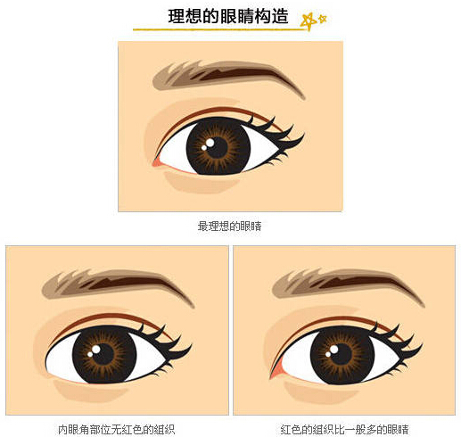 开内眼角,开外眼角,区别,长春好的整形医院