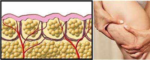 自体脂肪,填充,长春好的整形医院