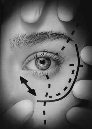 提眉术,长春好的整形医院