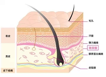 玻尿酸,填充,长春好的整形医院