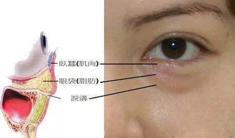 泪沟,长春好的整形医院