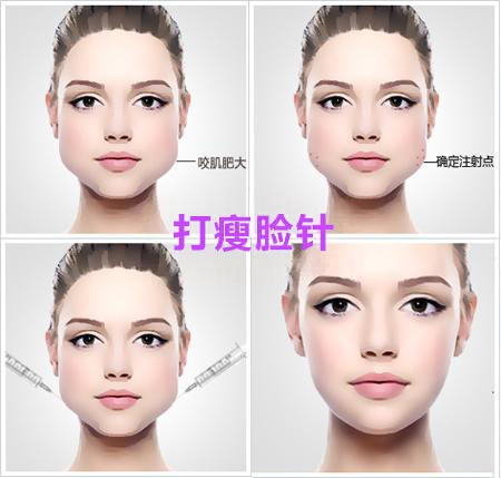 瘦脸针,瘦腿针,长春好的整形医院