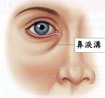 眼袋,泪沟,长春好的整形医院
