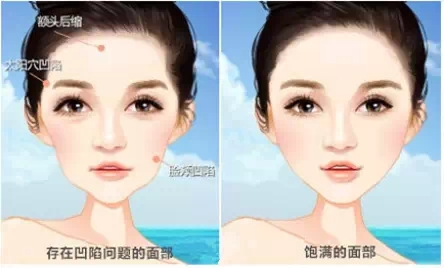 自体脂肪,移植,长春好的整形医院