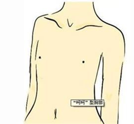 胸型,长春好的整形医院