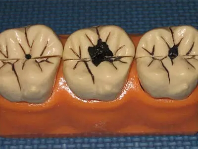 龋齿,长春好的整形医院