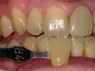 色素沉积,长春好的整形医院