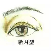 新月型,双眼皮,长春好的整形医院