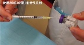 多汗症,肉毒素,长春好的整形医院