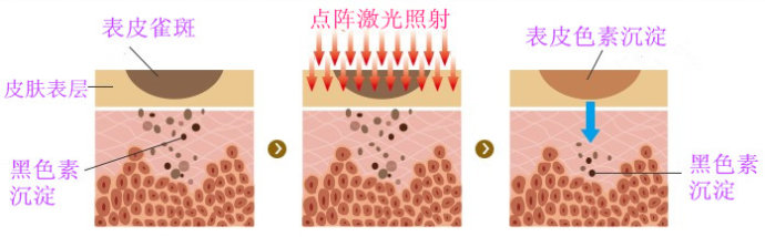 点阵激光,长春好的整形医院