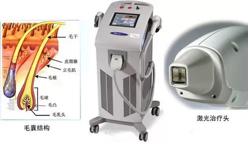 5度冰点,激光脱毛,长春好的整形医院