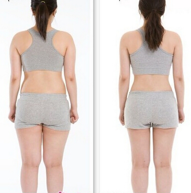 吸脂,对比图,长春好的整形医院