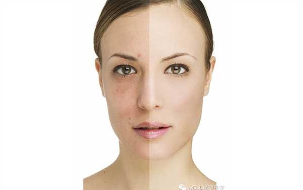 长春水光针,水光针哪里好,铭医水光针