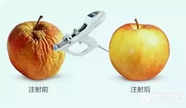 长春水光针,水光针哪里好,铭医水光针