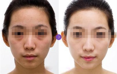 长春激光美白,长春铭医美白,激光美白