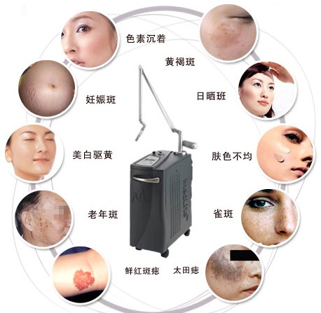 长春激光祛斑,铭医激光祛斑,激光祛斑价格