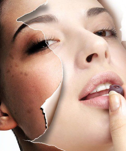 长春激光祛斑,铭医激光祛斑,激光祛斑价格