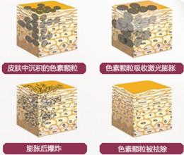 点痣对比图,长春铭医