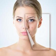 点痣对比图,长春铭医