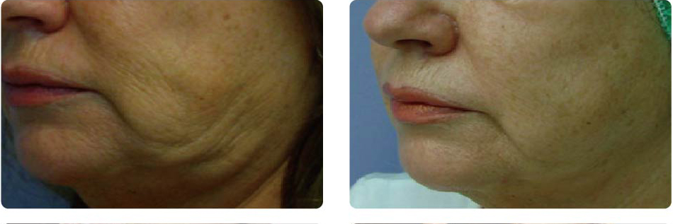 长春铭医,长春热拉提