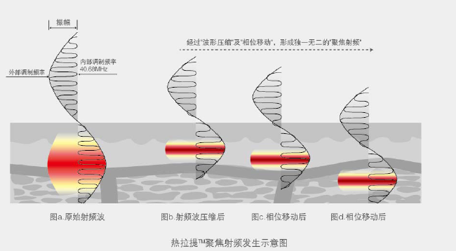 长春铭医长春热拉提