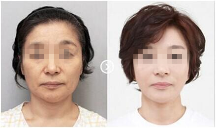 长春铭医,整形优惠