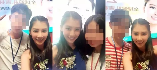 长春铭医,瑞蓝玻尿酸