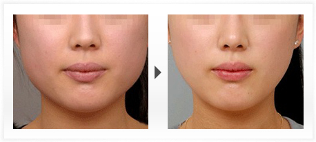 铭医整形,长春铭医,吉林铭医