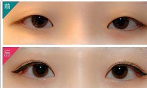 铭医整形,长春铭医,吉林铭医