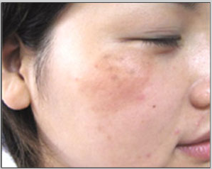 铭医整形,长春铭医,吉林铭医