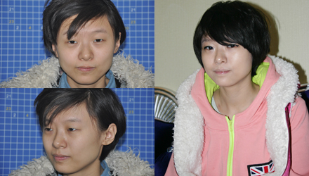 长春瘦脸,长春除皱,长春祛斑,长春隆鼻